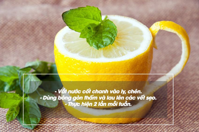 NhuCauLamDep.com