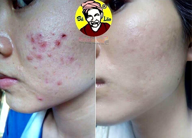 NhuCauLamDep.com